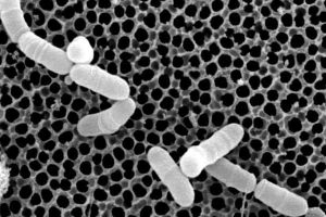 Propionibacterium  freudenreichii  sus Beneficios, usos y Contraindicaciones