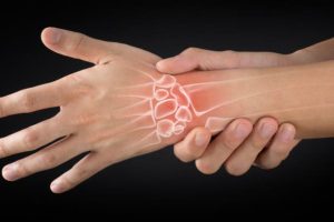 Medicina Natural para la Artritis Reumatoide